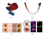 Leveraging Synthetic Data for Skin Lesion Analysis